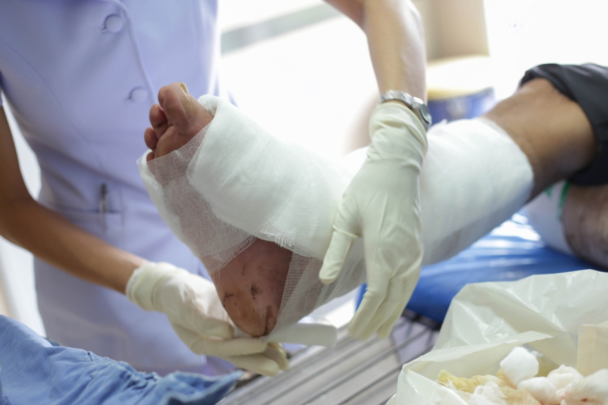 Orthopedic Treatment for Infected Wounds