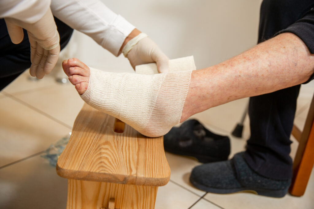 Orthopedic Treatment for Diabetic Foot Wound Care