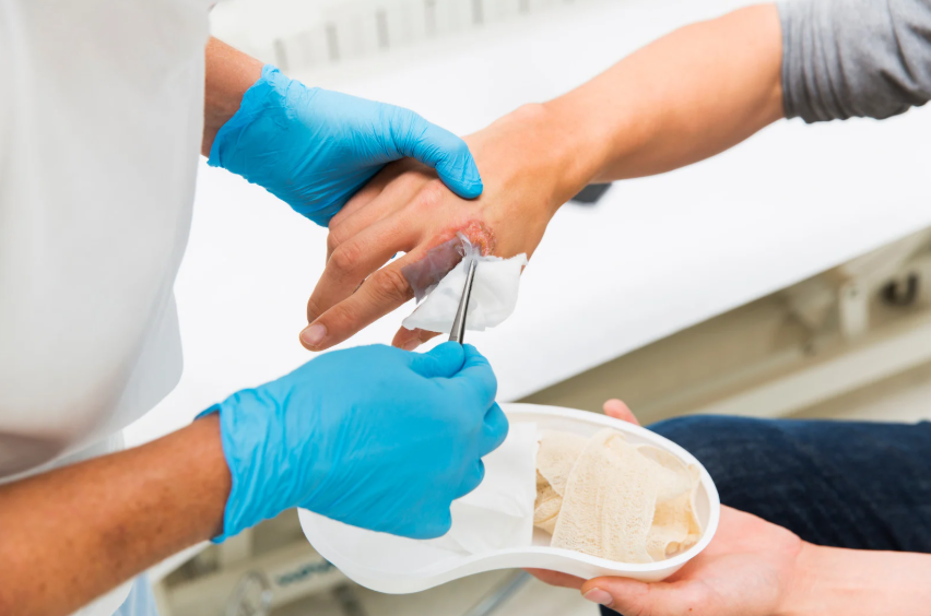 Wound cleaning services Philippines
