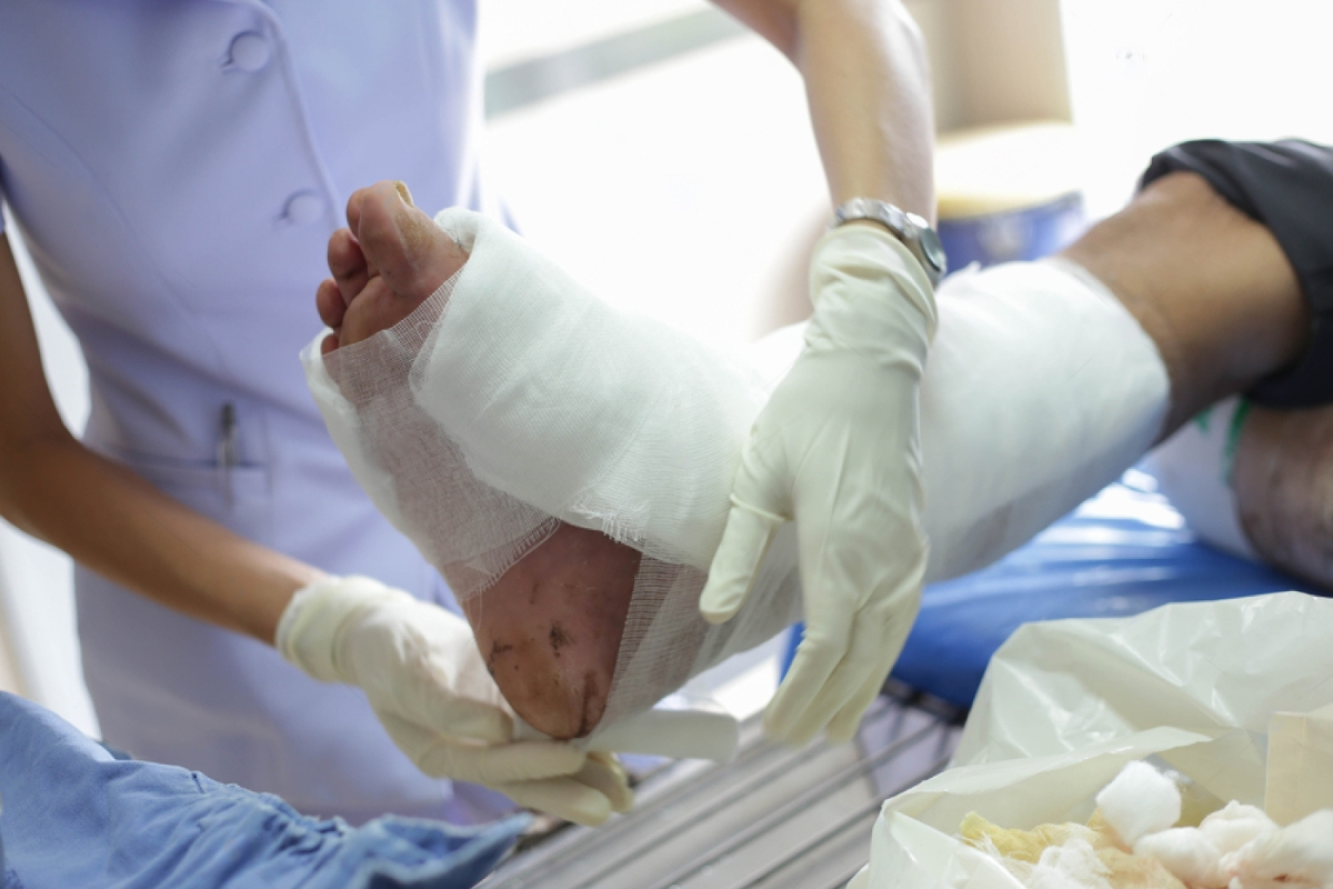 Effective Orthopedic Treatment for Infected Wounds and Faster Recovery