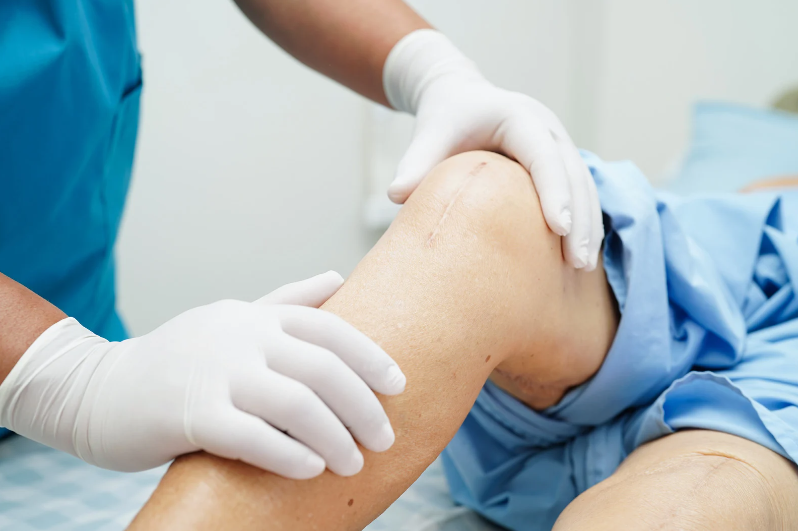 Expert Guide to Orthopedic Surgery in Quezon City