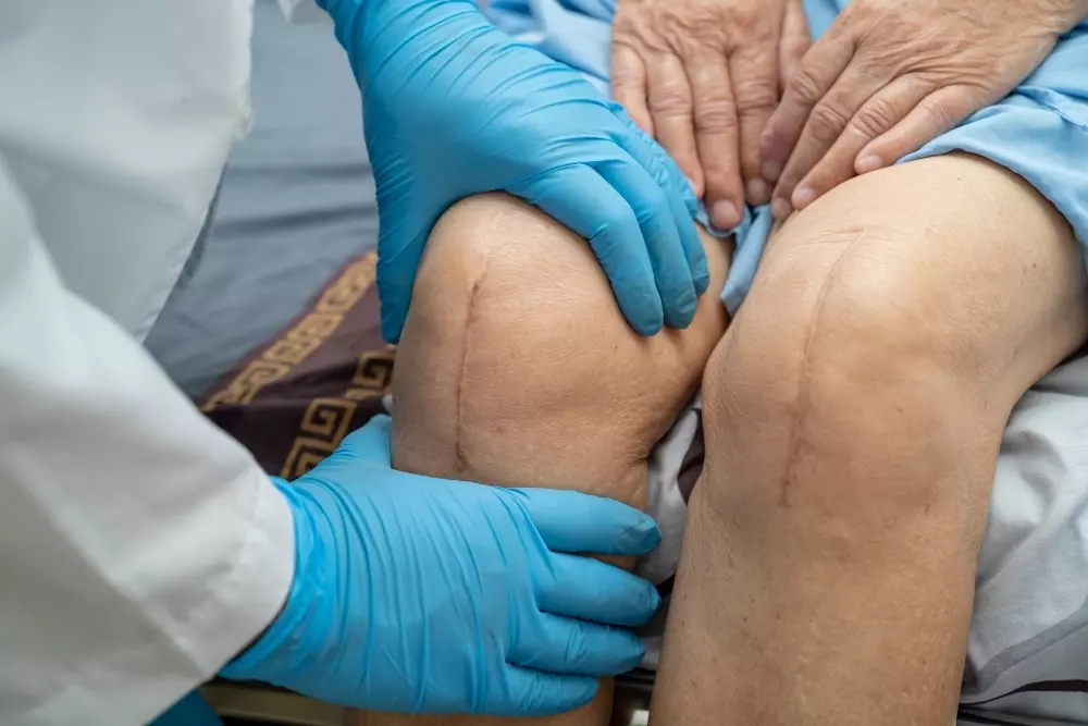Total Knee Replacement Restoring Mobility and Quality of Life Through Modern Orthopedic Solutions
